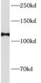 Adducin 1 antibody, FNab00324, FineTest, Western Blot image 