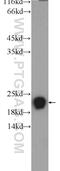 Ribosomal L24 Domain Containing 1 antibody, 25190-1-AP, Proteintech Group, Western Blot image 