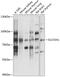 Solute carrier organic anion transporter family member 3A1 antibody, 15-462, ProSci, Western Blot image 