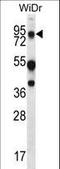 Mucin-20 antibody, LS-B15861, Lifespan Biosciences, Western Blot image 
