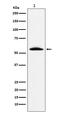 Gamma-glutamyltranspeptidase 1 antibody, M02340, Boster Biological Technology, Western Blot image 