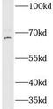 Caseinolytic Mitochondrial Matrix Peptidase Chaperone Subunit antibody, FNab09999, FineTest, Western Blot image 