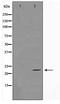 Anti-Silencing Function 1A Histone Chaperone antibody, TA347752, Origene, Western Blot image 