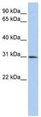 Distal-Less Homeobox 1 antibody, TA331568, Origene, Western Blot image 