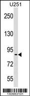 Pescadillo Ribosomal Biogenesis Factor 1 antibody, 60-328, ProSci, Western Blot image 
