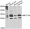 Methyltransferase Like 7B antibody, PA5-77164, Invitrogen Antibodies, Western Blot image 