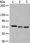 Solute Carrier Family 27 Member 4 antibody, PA5-67531, Invitrogen Antibodies, Western Blot image 