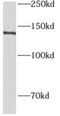 AOX1 antibody, FNab00281, FineTest, Western Blot image 