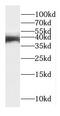 Homeobox protein DLX-4 antibody, FNab02419, FineTest, Western Blot image 