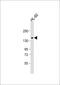 Centlein antibody, 56-896, ProSci, Western Blot image 