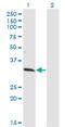 Zinc Finger Protein 101 antibody, MA5-22892, Invitrogen Antibodies, Western Blot image 