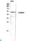 Cholinergic Receptor Nicotinic Alpha 9 Subunit antibody, LS-C814156, Lifespan Biosciences, Western Blot image 