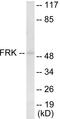 Fyn Related Src Family Tyrosine Kinase antibody, EKC1722, Boster Biological Technology, Western Blot image 