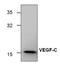 Vascular Endothelial Growth Factor C antibody, GTX59914, GeneTex, Western Blot image 