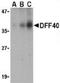 CAD protein antibody, GTX28407, GeneTex, Western Blot image 