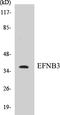 Ephrin B3 antibody, EKC1184, Boster Biological Technology, Western Blot image 