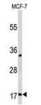 Destrin antibody, AP51327PU-N, Origene, Western Blot image 