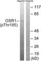 Odd-Skipped Related Transcription Factor 1 antibody, LS-C199364, Lifespan Biosciences, Western Blot image 
