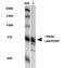 Protein Tyrosine Phosphatase Receptor Type F antibody, orb167652, Biorbyt, Western Blot image 