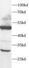 DNA Meiotic Recombinase 1 antibody, FNab10434, FineTest, Western Blot image 