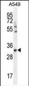 ANT2 antibody, PA5-35113, Invitrogen Antibodies, Western Blot image 