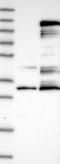 Centrobin, Centriole Duplication And Spindle Assembly Protein antibody, NBP1-82834, Novus Biologicals, Western Blot image 