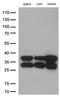 Cathepsin L1 antibody, LS-C796474, Lifespan Biosciences, Western Blot image 