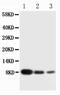 CXCL4 antibody, PA5-79808, Invitrogen Antibodies, Western Blot image 