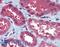 Nudix Hydrolase 21 antibody, LS-B15156, Lifespan Biosciences, Immunohistochemistry paraffin image 