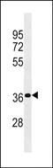 Pregnancy-specific beta-1-glycoprotein 4 antibody, PA5-49132, Invitrogen Antibodies, Western Blot image 