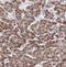 Tumor Protein P53 Inducible Nuclear Protein 1 antibody, FNab08879, FineTest, Immunohistochemistry paraffin image 