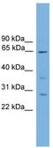 Chloride Channel CLIC Like 1 antibody, TA335945, Origene, Western Blot image 