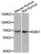 Essential Meiotic Structure-Specific Endonuclease 1 antibody, A8375, ABclonal Technology, Western Blot image 