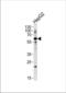 Zinc Finger With KRAB And SCAN Domains 8 antibody, TA328183, Origene, Western Blot image 