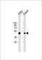 C-C Motif Chemokine Receptor 7 antibody, M00390-1, Boster Biological Technology, Western Blot image 