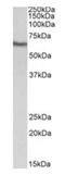 Gamma-Glutamyltransferase 1 antibody, orb99063, Biorbyt, Western Blot image 