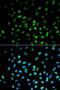 Serine/Threonine Kinase 11 antibody, orb48550, Biorbyt, Immunofluorescence image 