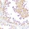 Diablo IAP-Binding Mitochondrial Protein antibody, GTX64409, GeneTex, Immunohistochemistry paraffin image 