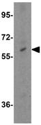 Neuropilin And Tolloid Like 1 antibody, GTX31454, GeneTex, Western Blot image 