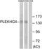 Pleckstrin Homology And RhoGEF Domain Containing G4 antibody, A10252, Boster Biological Technology, Western Blot image 