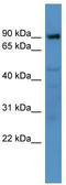 ADAM Metallopeptidase Domain 22 antibody, TA339397, Origene, Western Blot image 
