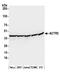 Actin Related Protein 2 antibody, A305-216A, Bethyl Labs, Western Blot image 