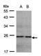 NADH:Ubiquinone Oxidoreductase Subunit B9 antibody, LS-C185712, Lifespan Biosciences, Western Blot image 