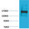 Ectopic P-Granules Autophagy Protein 5 Homolog antibody, GTX34366, GeneTex, Western Blot image 