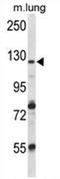 Vacuolar protein sorting-associated protein 54 antibody, AP54518PU-N, Origene, Western Blot image 