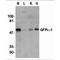 GDNF family receptor alpha-1 antibody, TA305952, Origene, Western Blot image 