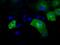 Intraflagellar Transport 57 antibody, GTX84310, GeneTex, Immunofluorescence image 