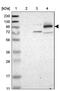 Rho Guanine Nucleotide Exchange Factor 11 antibody, PA5-52897, Invitrogen Antibodies, Western Blot image 