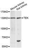 TEK Receptor Tyrosine Kinase antibody, LS-C746753, Lifespan Biosciences, Western Blot image 