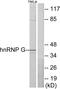 Heterogeneous nuclear ribonucleoprotein G antibody, A04738-1, Boster Biological Technology, Western Blot image 